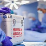 Human Organ Transplantation