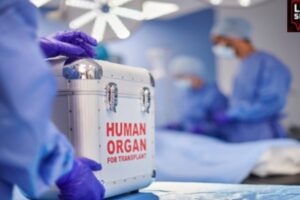 Human Organ Transplantation